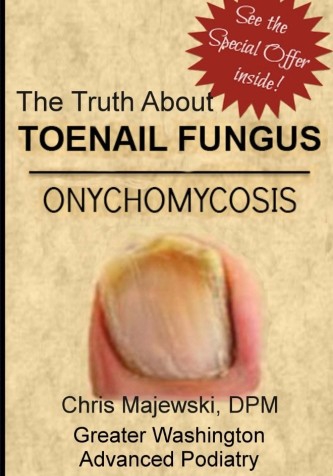 The Truth About Toenail Fungus | Greater Washington Advanced Podiatry, LLC
